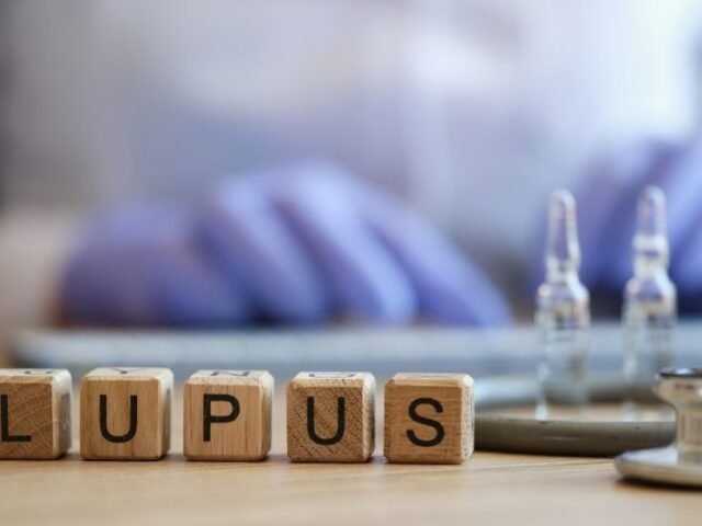 lúpus ayurveda